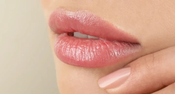 Preenchimento Labial – Drª Thaís Gobbo Dermatologista